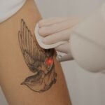 ¿Te preocupa el dolor al eliminar un tatuaje con láser? En La Femme Beauty te explicamos todo. ¡Reserva tu cita y elimina tu tatuaje de forma segura!