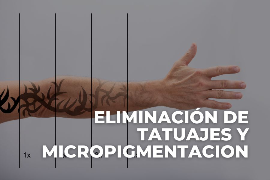 Eliminación de tatuajes y micropigmentacion El Prat de Llobregat