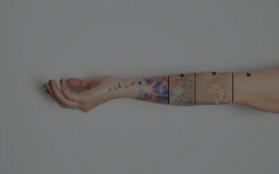 Eliminación de tatuajes con láser en pieles sensibles