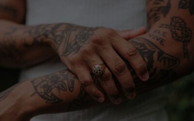 ¿Puedo hacerme eliminación de tatuajes con láser si estoy bronceado?