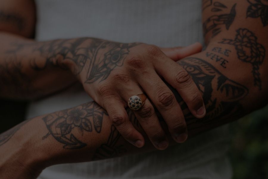 ¿Puedo hacerme eliminación de tatuajes con láser si estoy bronceado?