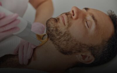 Depilación láser para hombres: todo lo que debes saber