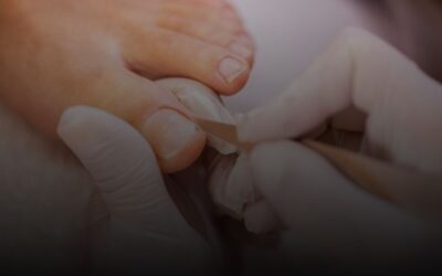 Qué es una pedicura clásica y cuáles son sus beneficios