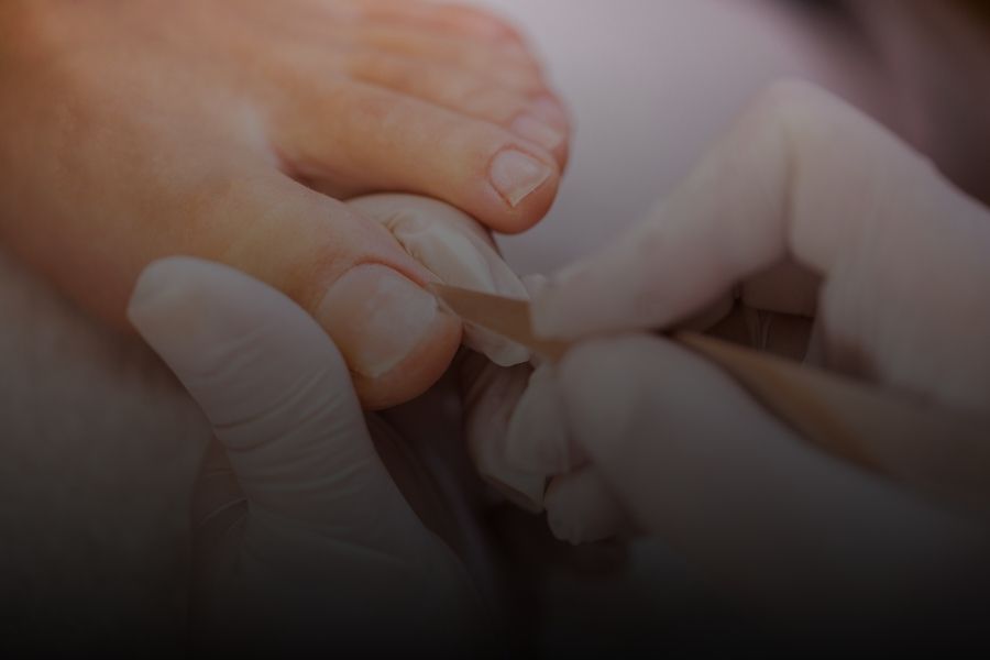 Qué es una pedicura clásica y cuáles son sus beneficios