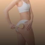 Presoterapia y su efecto en la piel