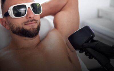 Beneficios estéticos y prácticos de la depilación láser masculina