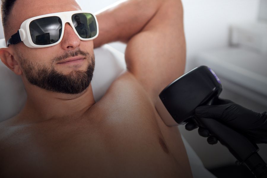 Beneficios estéticos y prácticos de la depilación láser masculina