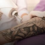 ¿Es seguro eliminar tatuajes durante el embarazo?