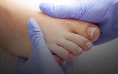 Cuidado de los pies en invierno: consejos profesionales