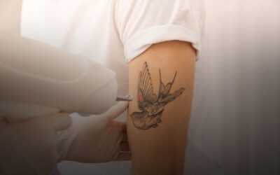 ¿Qué hacer si un tatuaje no se elimina por completo?