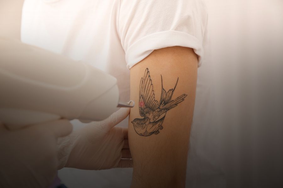 ¿Qué hacer si un tatuaje no se elimina por completo?