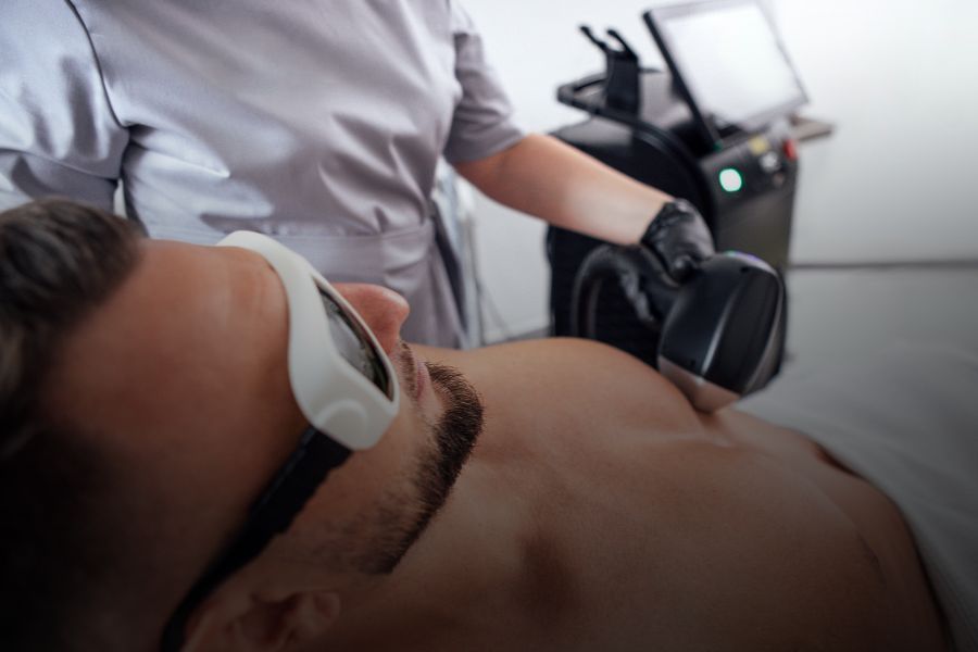 Depilación láser en espalda y pecho