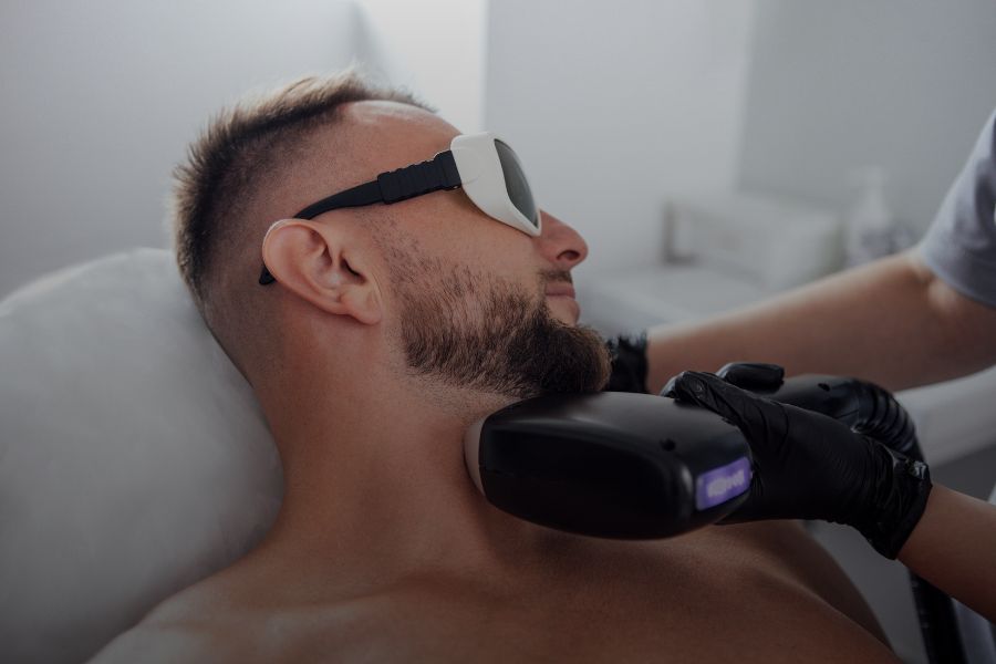 ¿Depilación láser con barba o bigote?