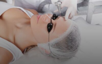 Eliminar micropigmentación de cejas en pieles sensibles