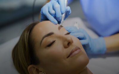 Técnica combinada para cicatrices en cejas: ¿es recomendable?