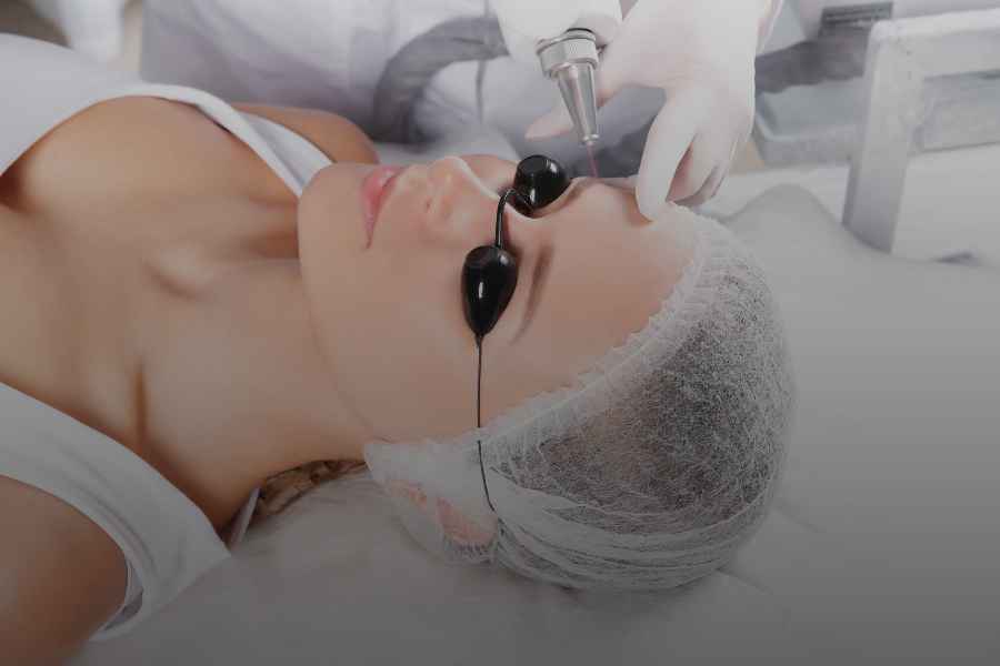 Beneficios de eliminar la micropigmentación con láser