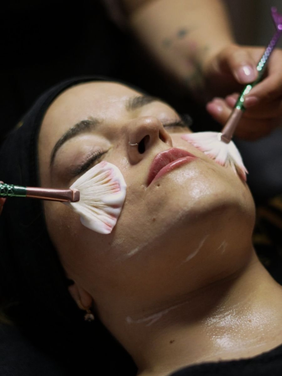 Tratamiento facial Vitamina C con Dermapen en La Femme Beauty